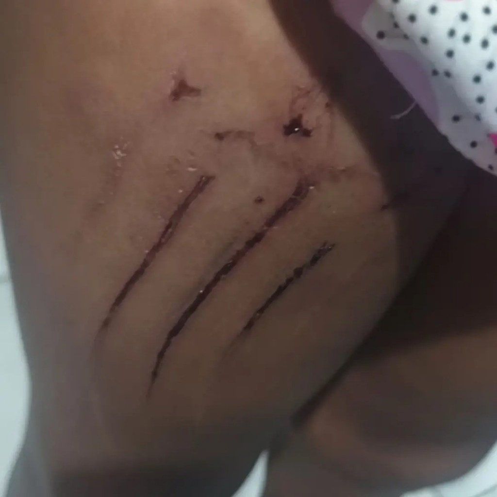 Ferimento em criança de 4 anos em shopping busca busca